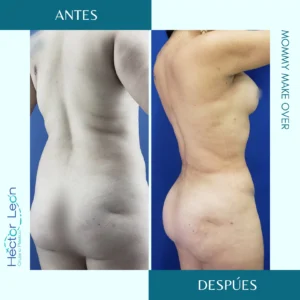 Mommy Make Over, resultado en tus 360 grados